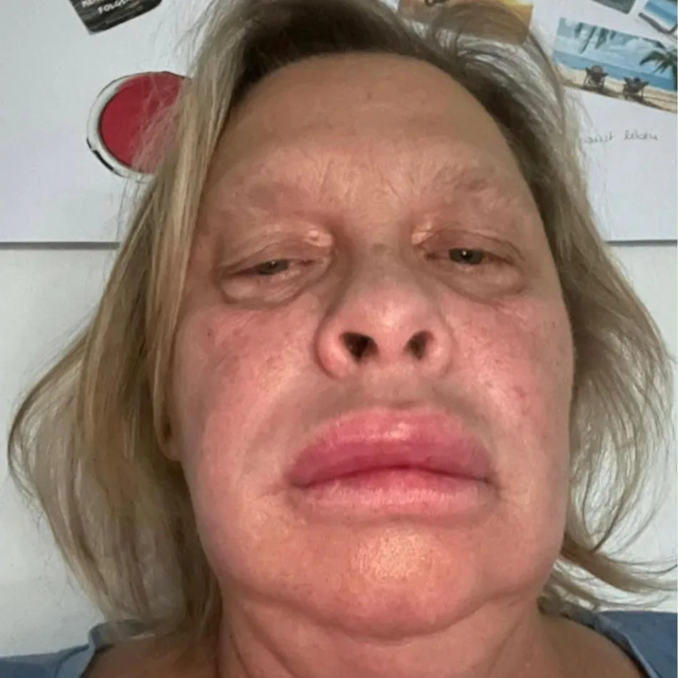 Claudia Boeckhoff - Vorher